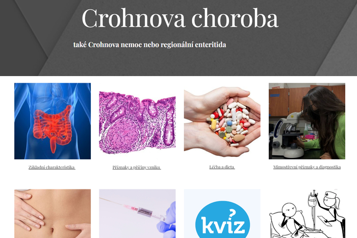 Crohnova choroba